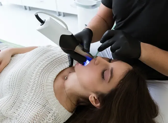 CEREC wand